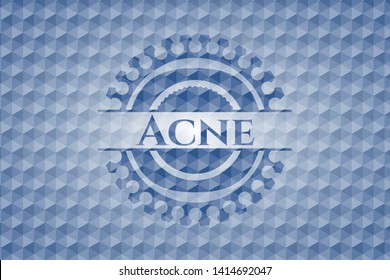 Acne blue badge with geometric pattern. Vector Illustration. Detailed.