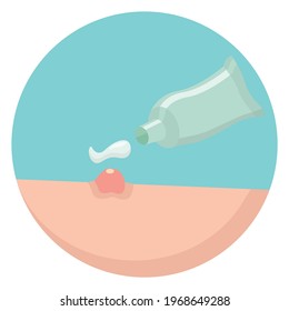 Acne and breakout solution. Applying cream from tube on pimple. Can be used for topics like skincare treatment, blemish relief, moisturizer. Oily skin, problem, whitehead concept 