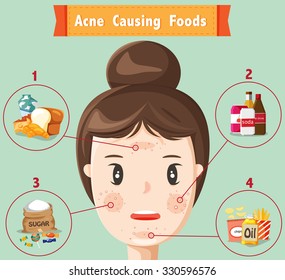 1,106 Acne Causing Images, Stock Photos & Vectors 