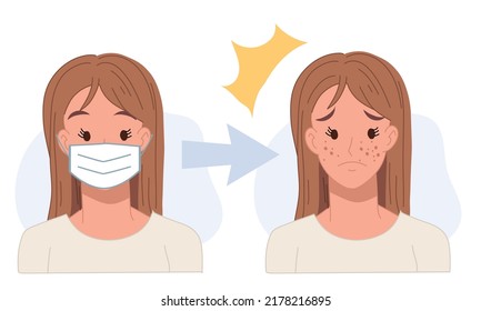 Acne caused wearing face mask.acne concept.pimples. skin problems .Flat vector cartoon character illustration.