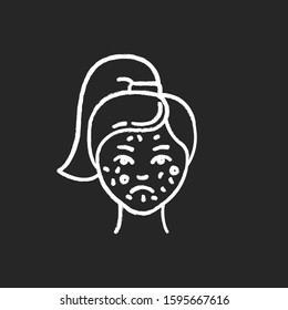 Acne chalk icon. Pimples on female face. Skincare for inflammation and irritation. Facial treatment. Puberty and teenager health problem. Dermatology. Isolated vector chalkboard illustration