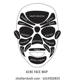 Acne Face Map. Vector black and white illustration with viscera location map on the face. Skin Mapping. The internal organs of the face. Your health is on your face