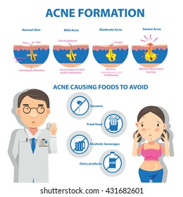  Acne formation Info Graphic and diagrams.Vector illustrations