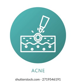Relleno Del Gradiente Del Acné, Mini Icono De La Ilustración Relativo Al Cuidado Personal, Tienda De La Belleza, Cuidado Corporal Y Más. Uso Para El Concepto Moderno, Ui, Web Ux Y Desarrollo De App.