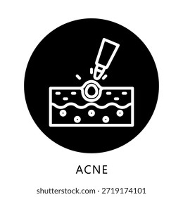 Botón Del Icono Del Acné, Mini Ilustración Relacionada Con El Cuidado Personal. Uso Para El Concepto Moderno, Ui, Web Ux Y Desarrollo De App.