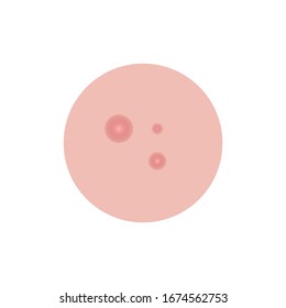 Acne icon design isolated on white background. Vector illustration