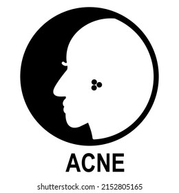 Acne icon in modern silhouette style design. Vector illustration isolated on white background.