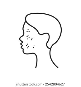 Acne icon simple black line style.