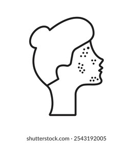Ícone de acne. ícone de vetor simples.
