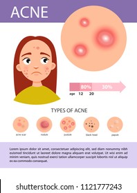 Acne infographics. Illustration of a sick girl. Information about the disease