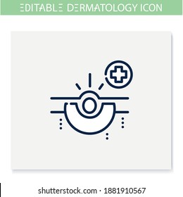 Acne line icon. Skin problem, dermatologic disease. Comedone, inflamed pimple. Skincare, cosmetology, medicine. Health and beauty concept. Isolated vector illustration. Editable stroke 