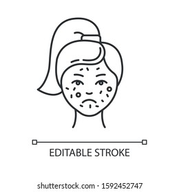 Acne linear icon. Pimples on female face. Skincare for inflammation. Cosmetology and dermatology. Thin line illustration. Contour symbol. Vector isolated outline drawing. Editable stroke