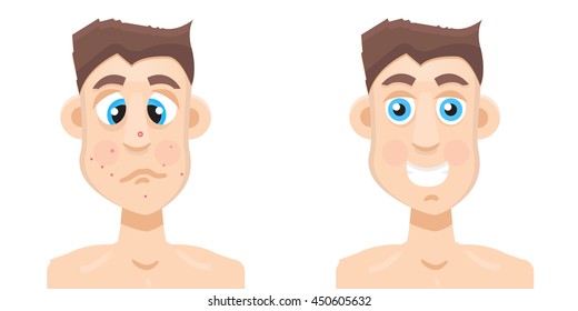 acne man