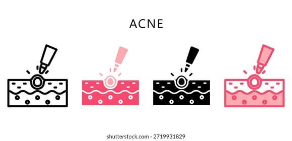 Icono de estilo múltiple de acné. Mini Ilustración Relacionada Con El Cuidado Personal. Uso Para El Concepto Moderno, Ui, Web Ux Y Desarrollo De App.