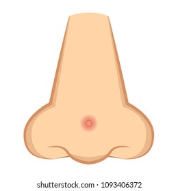 Acne on the nose vector. free space for text. wallpaper. background.