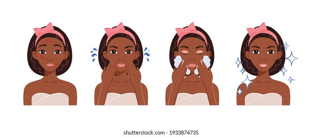 Acne and Pimple Treatment. Black Teenager Girl with a Bow on Head Washes Face, Uses Foam. Steps. Ugly. African American Woman with Problem Skin. Cartoon flat color style. White background. Vector