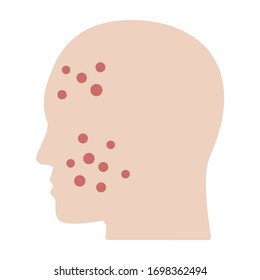 Acne or pimples on face flat vector color icon for medical apps and websites