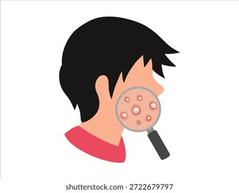 Acne Pústula Na Pele Da Face