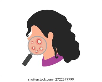Acne Pústula Na Pele Da Face