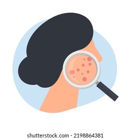 acne skin. Examination of the problematic skin of an aged woman through a magnifying glass