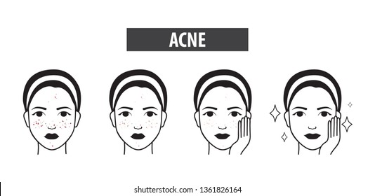 Acne Skin Icon Of Woman To Clear Steps Vector Illustration