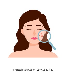 Acne skin problem concept. Woman face with magnifying glass and red pimples on skin.