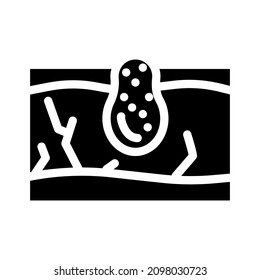 Akne Haut Problem Glyphe Symbol Vektorgrafik. Akne-Hautproblematisch-Schild. isoliertes Kontursymbol