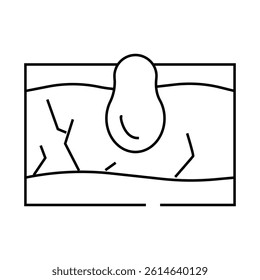 acne skin problem line icon vector. acne skin problem sign. isolated contour symbol black illustration