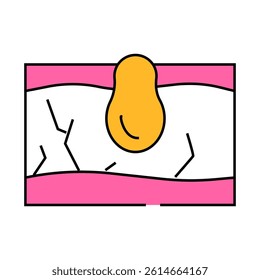 acne skin problem line icon vector. acne skin problem sign. isolated symbol illustration