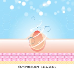acne skin spot pimple problem vector design.