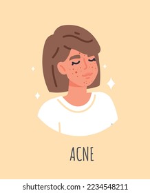 Acne skin type. Young girl with problematic skin on her face. Cosmetic preparations to combat wrinkles and blackheads metaphor. Poster or banner for website. Cartoon flat vector illustration