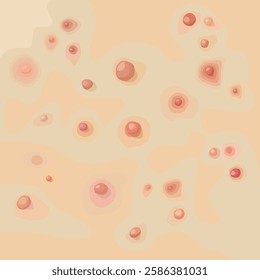 Acne texture, pimple different shapes and colors on fair skin. Cosmetic infographics, skin care. Vector illustration