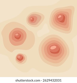 Acne texture, pimple different shapes and colors on fair skin. Cosmetic infographics, skin care. Vector illustration