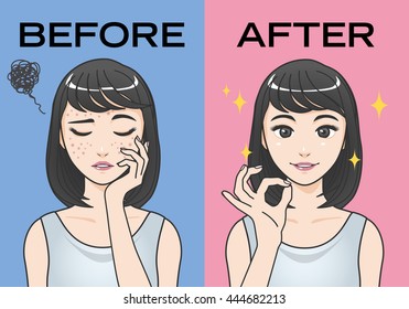 acne treatment before after cartoon illustration svg