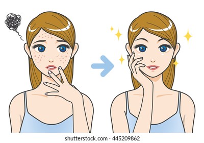 acne treatment before after cartoon illustration svg