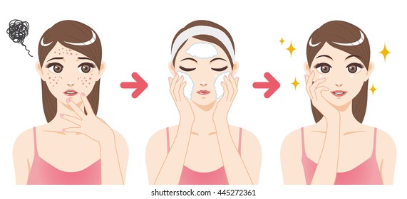 acne treatment before after, facial cleansing foam, cartoon illustration svg