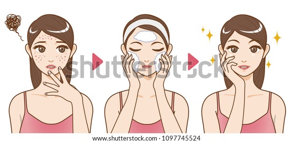 Acne Treatment Before After Facial Cleansing Stock Vector (Royalty Free ...