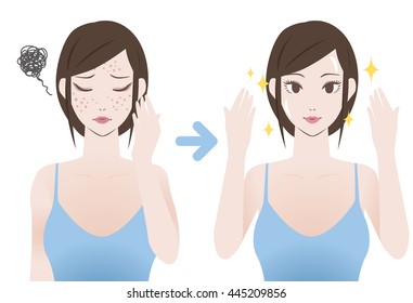 acne treatment before after image illustration