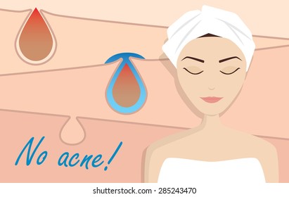 Acne treatment illustration, beauty vector