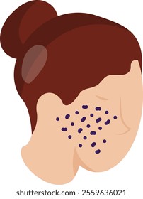 Acne Treatment isometric concept, Skin Resurfacing or Microdermabrasion vector icon design, beauty personal care symbol, cosmetic dermatology sign, body aesthetics stock illustration