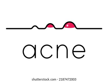 Acne treatment. Acne Positivity Day. Skin Care. Beauty concept. Acne complexion dermal dermatology pimple skin