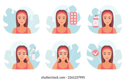 Acne treatment set vector illustration. Cartoon medical infographic collection with cleaning routine of girl for care of oily skin with blotch and pimple, cosmetic skincare procedures and medicines