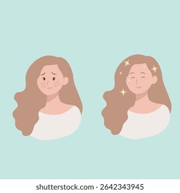 Acne treatment, skin, face, before, after, Asian, scars, happy, sad, women, girl, isolated, adult, formation, closeup, teenager, care, lady, young,pimples, blackheads, and blemishes skin conditions