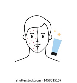 Acne treatments male character outline vector icon