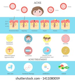 Tipos de acné, causas e infografías de tratamiento, ilustración de diseño de estilo plano vectorial. Enfermedad de la piel, trastorno inflamatorio dermatológico. El acné comete la formación, el cuidado de la piel y el diagrama de terapia médica.