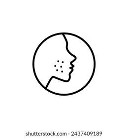 Acne Vector Line Icon illustration.