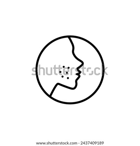 Acne Vector Line Icon illustration.