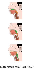 The actions involved in the swallowing of a food bolus, showing how the epiglottis is used to prevent inhalation of food.