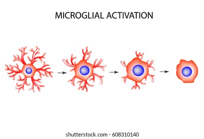 Activation of microglia. Neuron. Nerve cell. Infographics. Vector illustration on isolated background