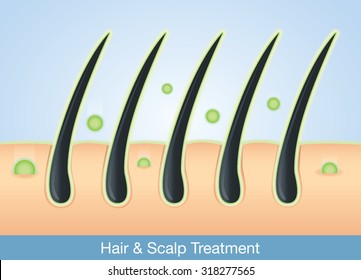 Active Ingredient Treatment Deep Into Hair And Scalp.